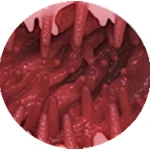 #5 Tentacle Hell
