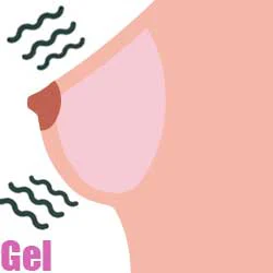 Gel (FREE)